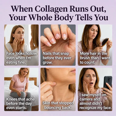 Multi Collagen Complex 8:1 - Complete Beauty Collagen