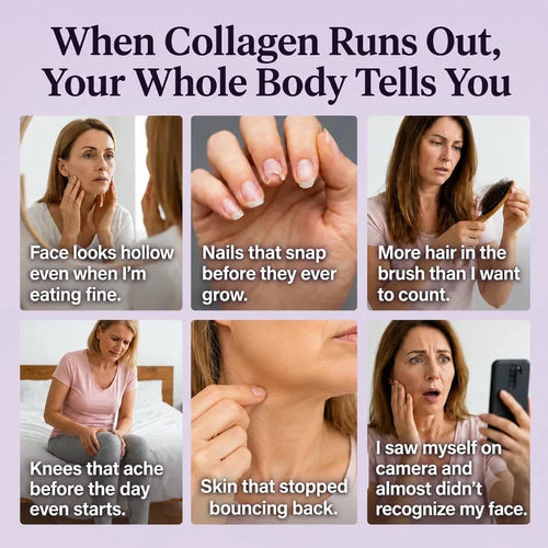 Multi Collagen Complex 8:1 - Complete Beauty Collagen