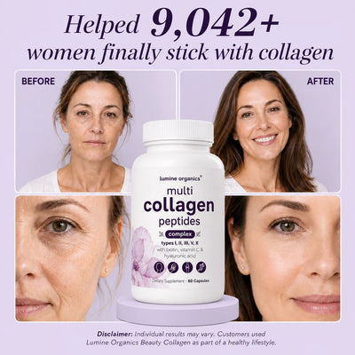 Multi Collagen Complex 8:1 - Complete Beauty Collagen